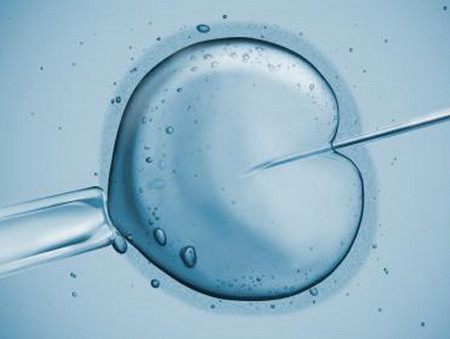 PGT三代试管